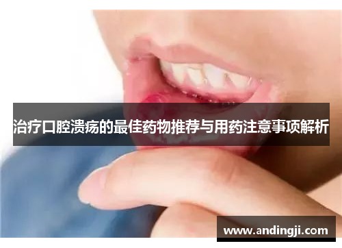 治疗口腔溃疡的最佳药物推荐与用药注意事项解析